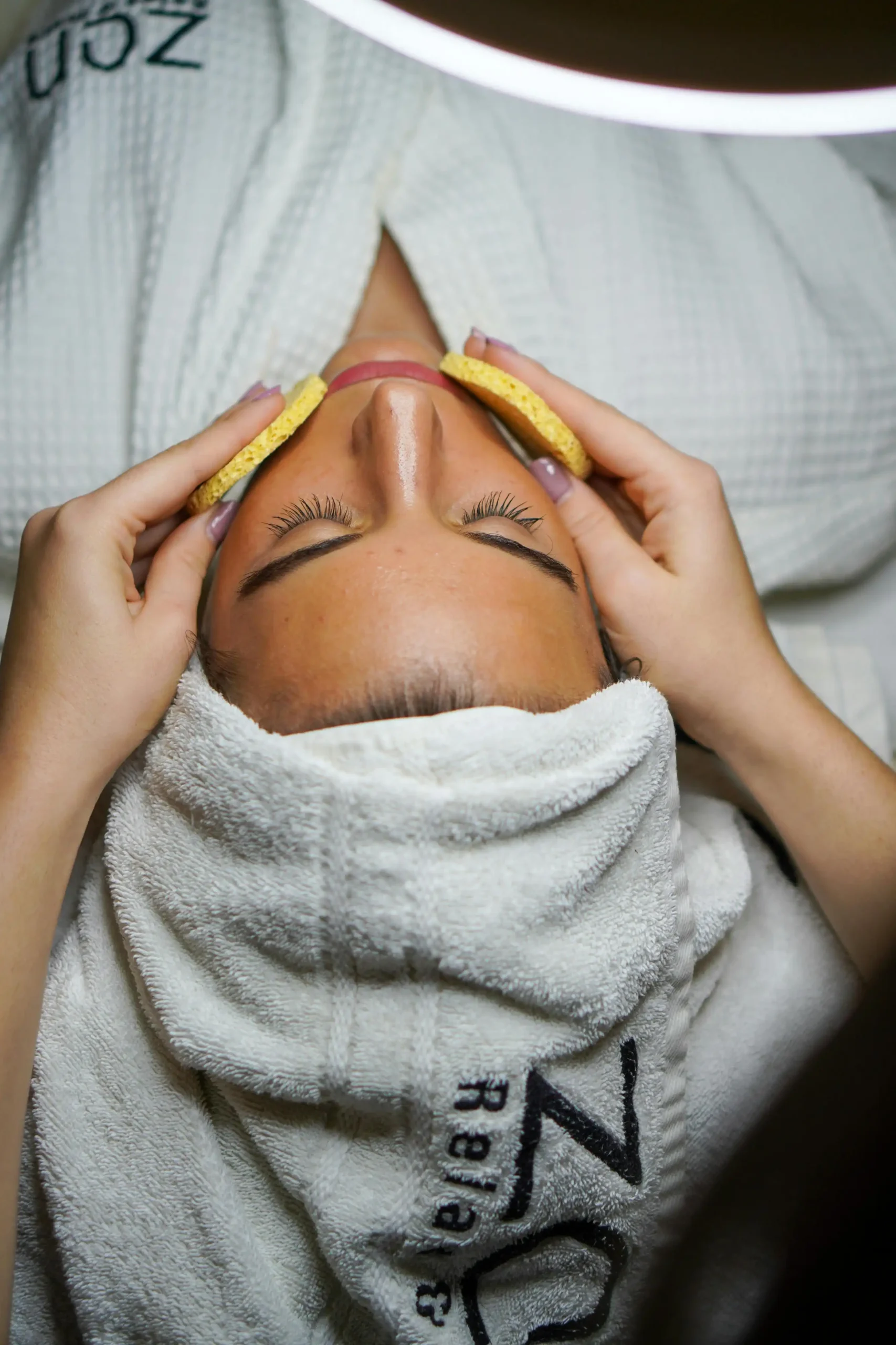 Microdermabrasion Treatment